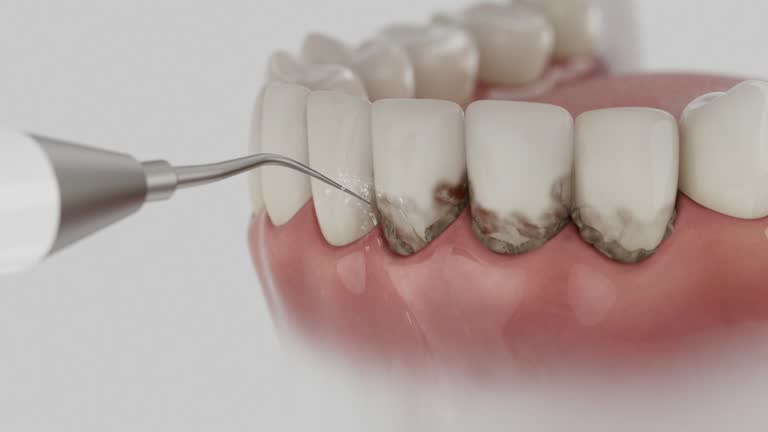 Trusted Dental Implants service in Frazier Park, CA - Dentist Open Now